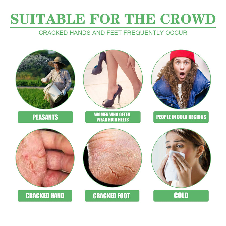Cracked Heel Repair Cream for Dry Hands and Feet