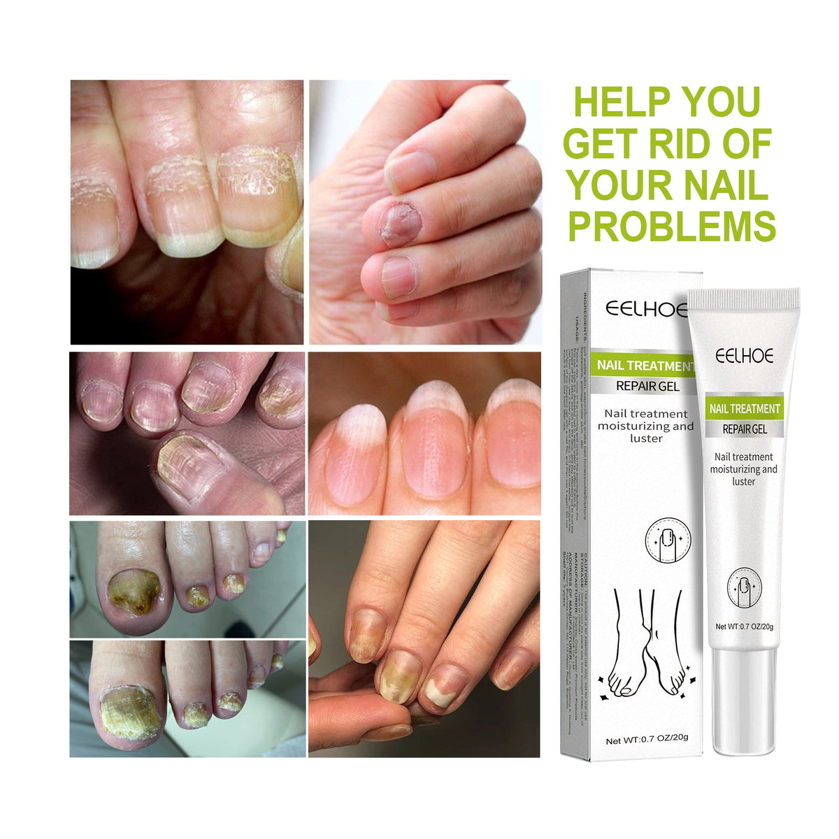 Nail Repair Gel for Damaged, Discolored, Brittle Nails