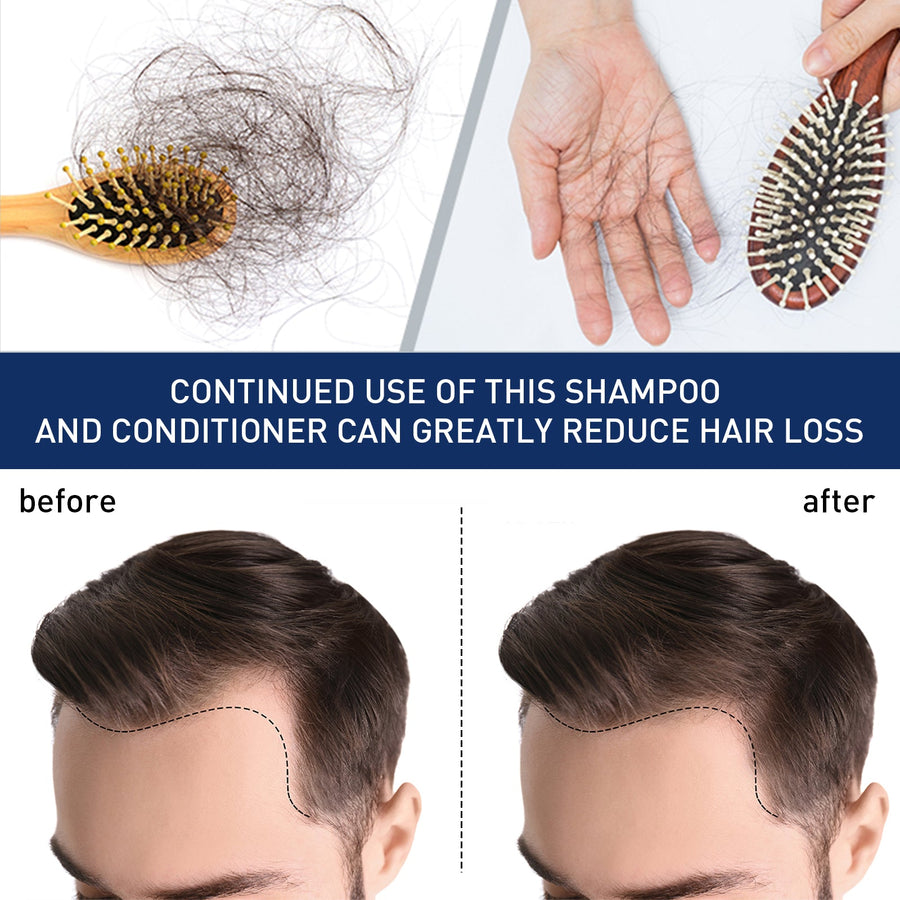 Scalp Hair Growth Cream for Thinning and Oily Roots