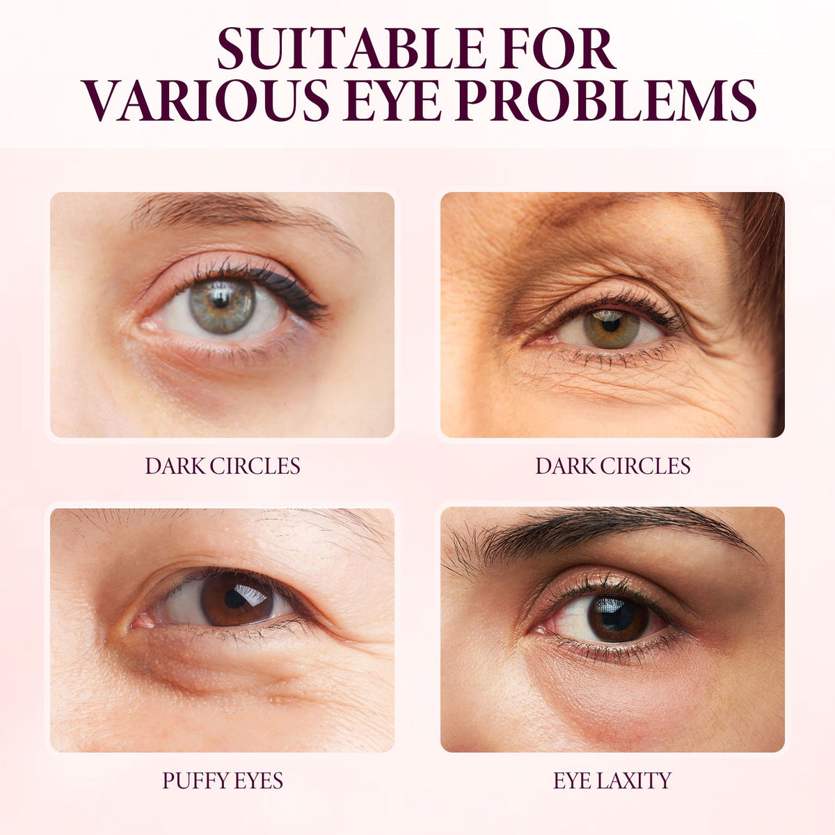 Mango Eye Cream for Fine Lines, Puffiness & Dark Circles