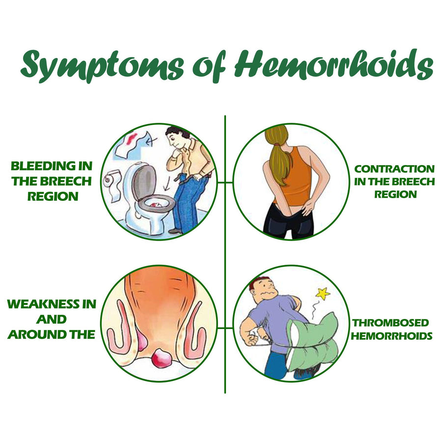Hemorrhoid Spray — Botanical Pain & Swelling Relief