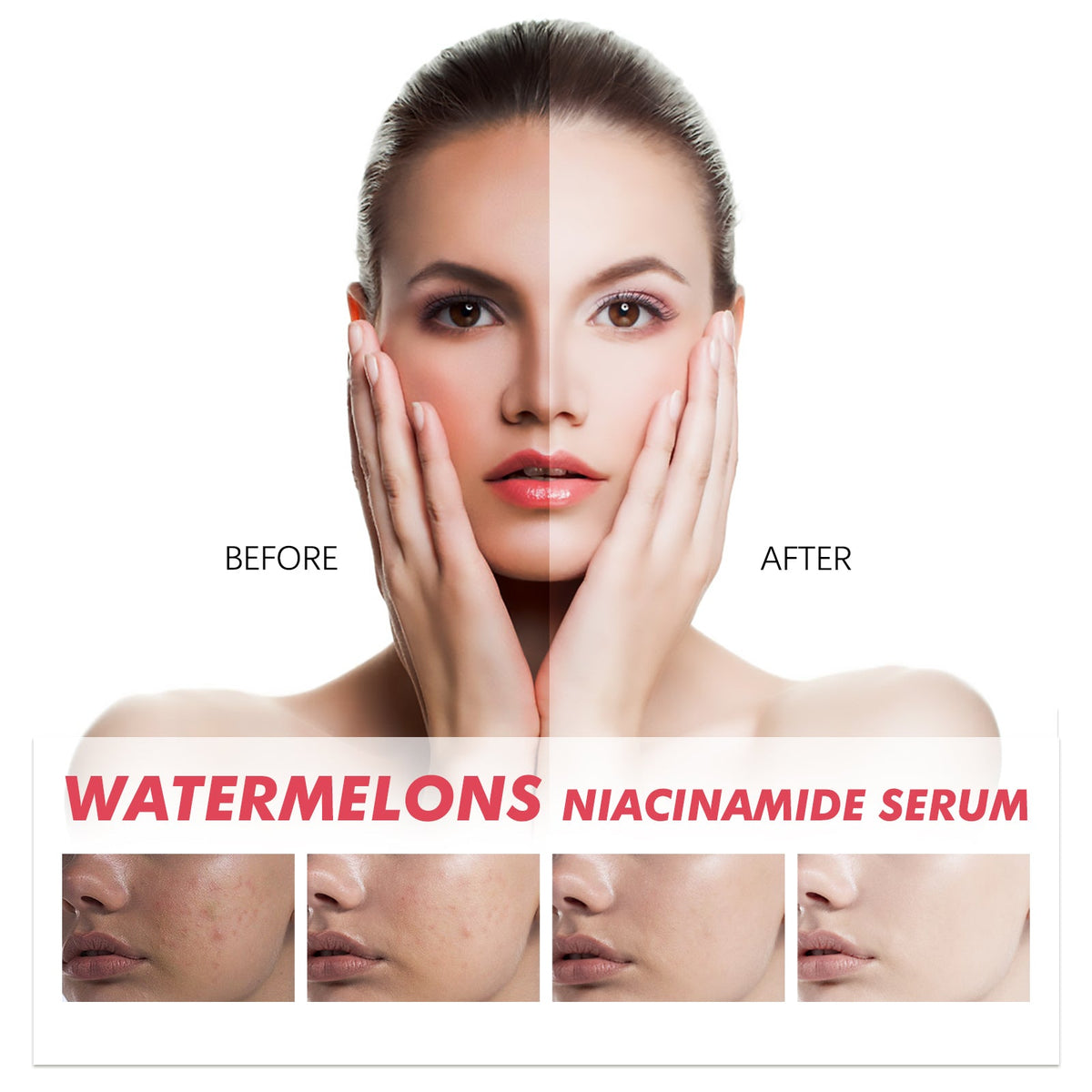 Watermelon Niacinamide Serum for Even Skin Tone