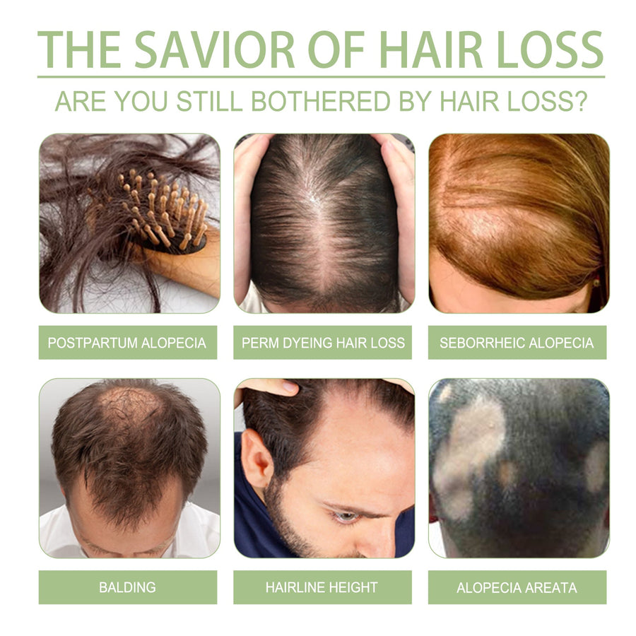 Herbal Hair Oil for Fuller-Looking, Softer Hair Care