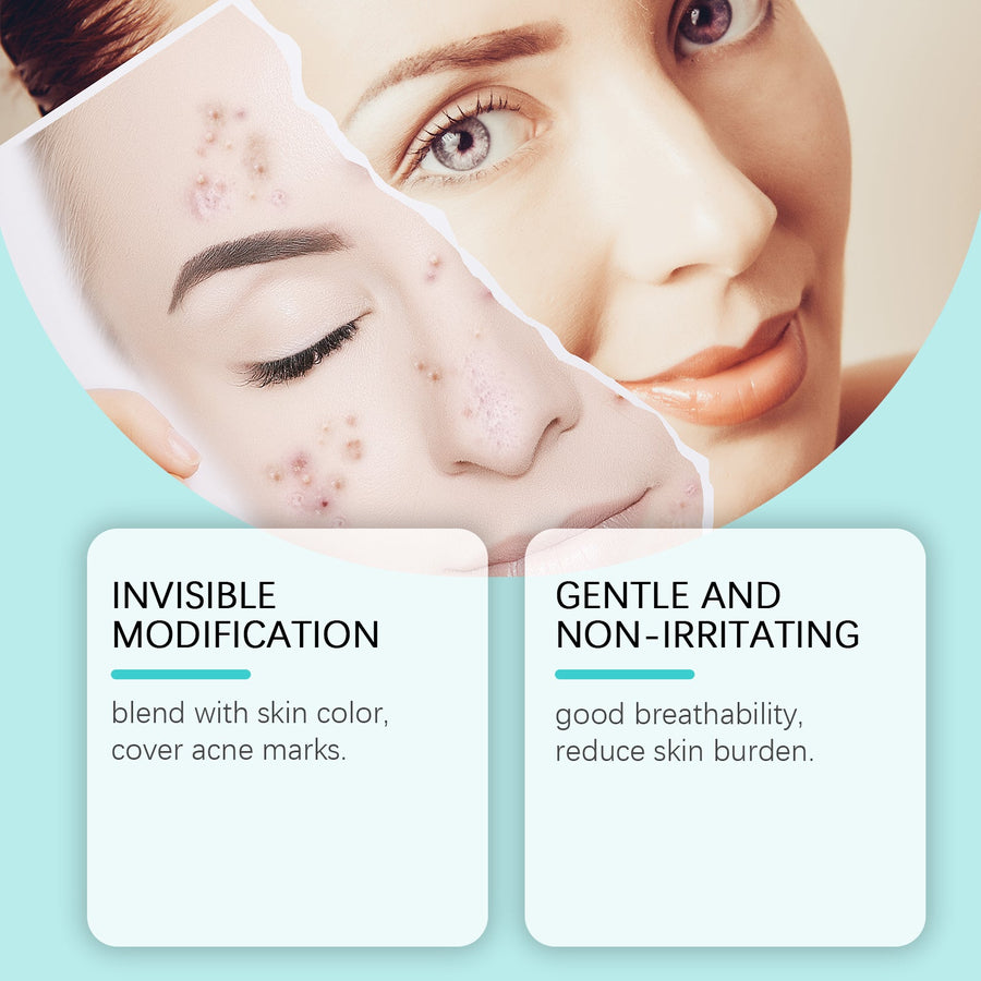 Ouhoe Micropoint Acne Patches for Spots and Blemishes