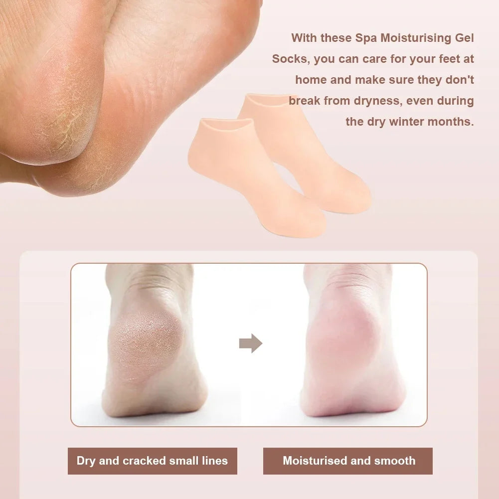 Moisturizing Gel Heel Socks – Repair Dry, Cracked Feet