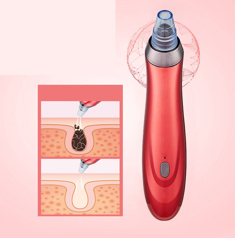Facial Pore Cleaner with Suction — Removes Blackheads