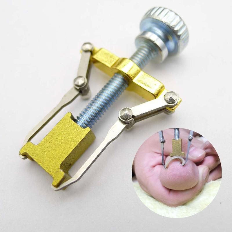 Ingrown Toenail Corrector — Safe, Non-Invasive Pain Relief