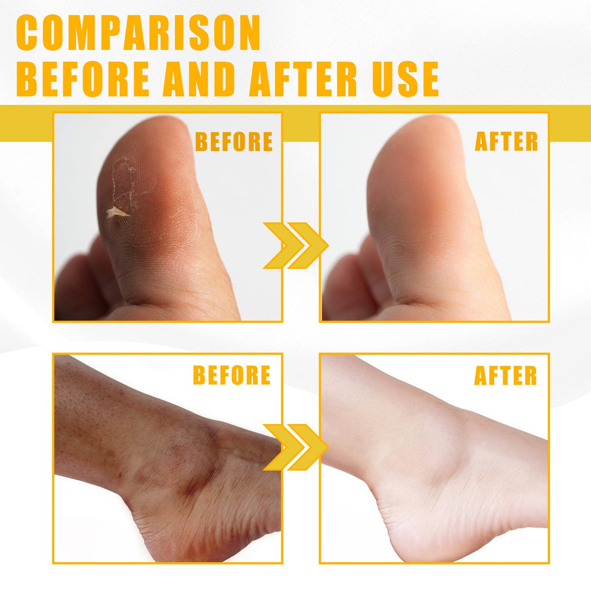 Yellow Exfoliating Oil for Dull, Rough Uneven Skin
