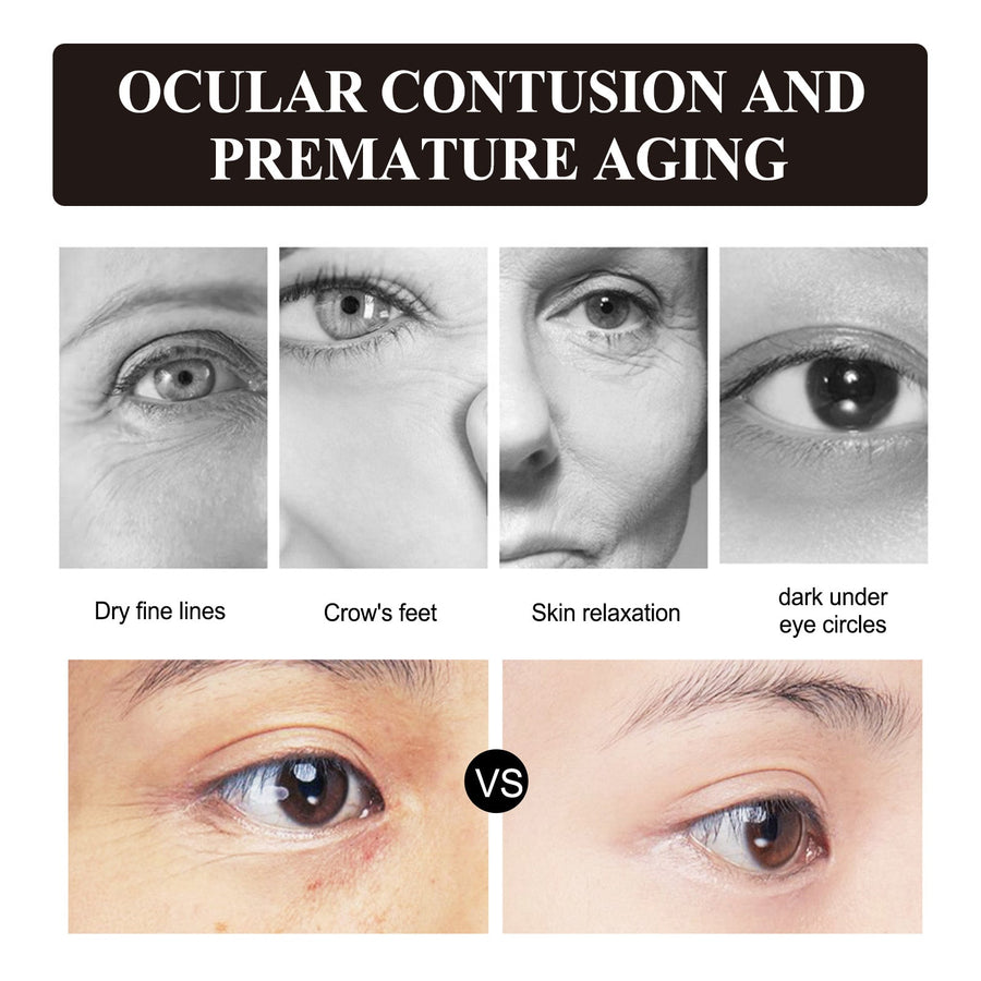 Retinol Eye Cream for Fine Lines & Under-Eye Wrinkles