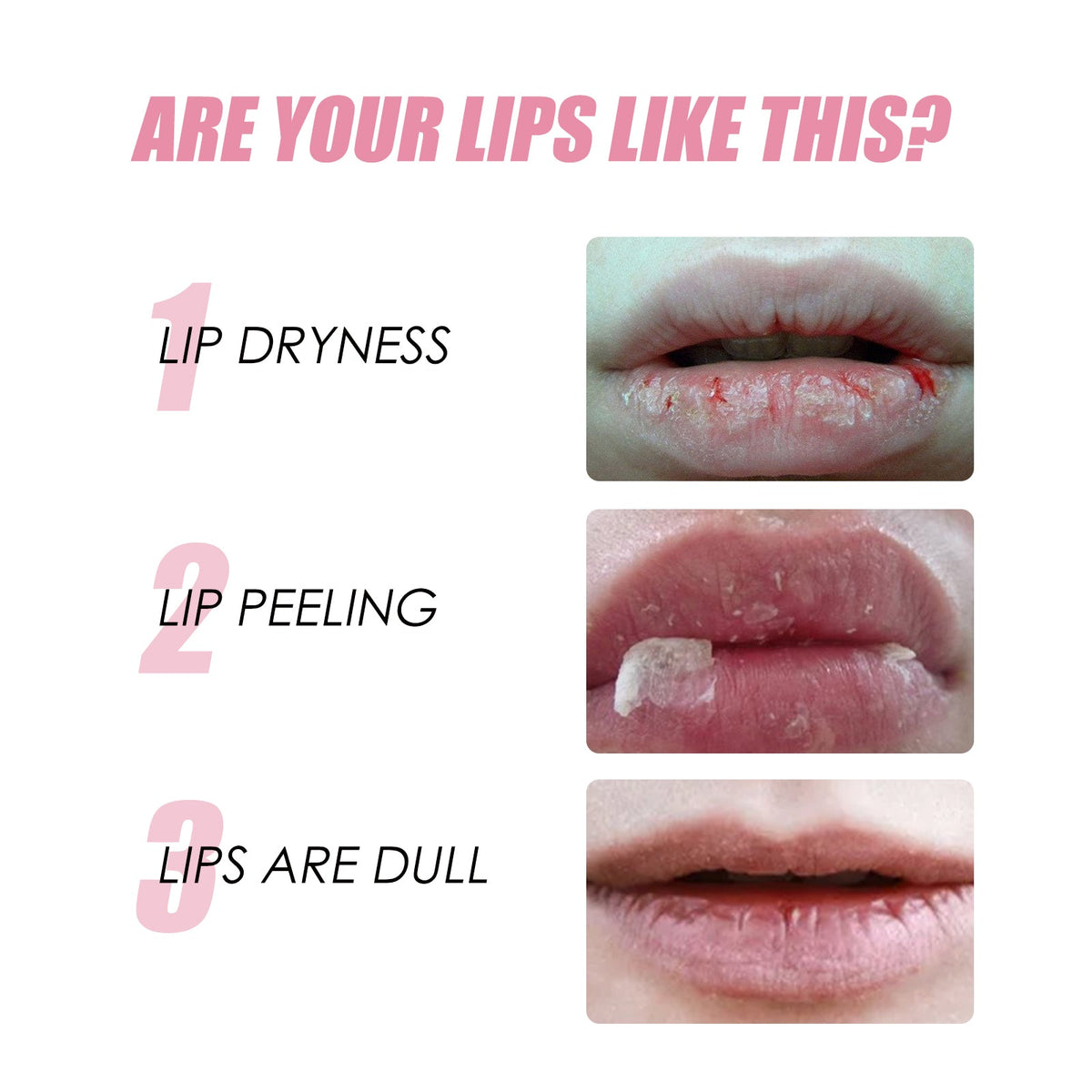 Honey Lip Oil for Dry, Cracked Lips - Plumping Glow