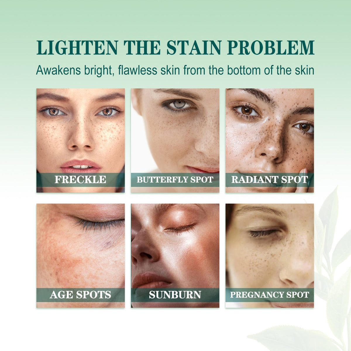 Brightening Blemish Essence for Dark Spots & Melasma