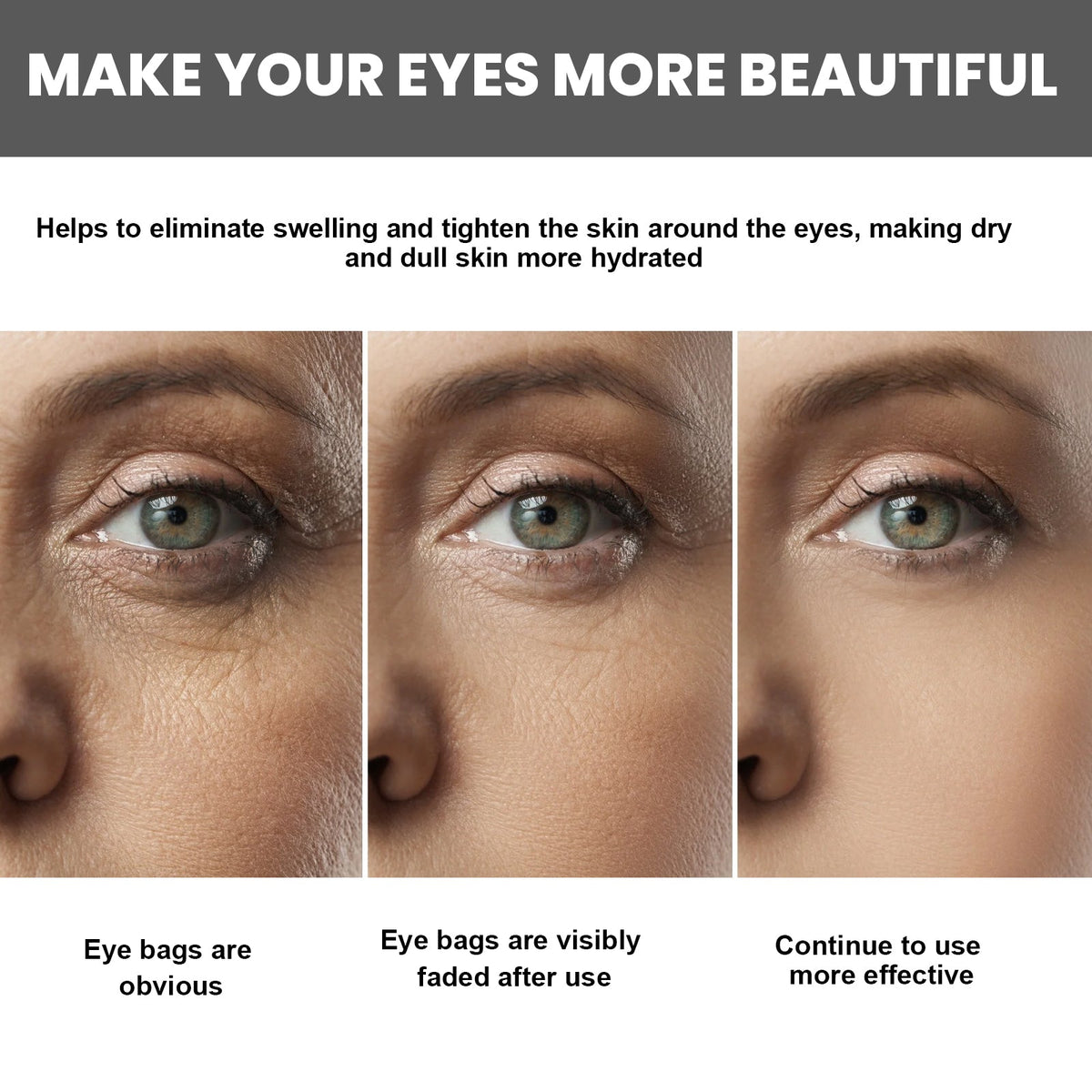 Rollerball Eye Cream for Dark Circles & Fine Lines