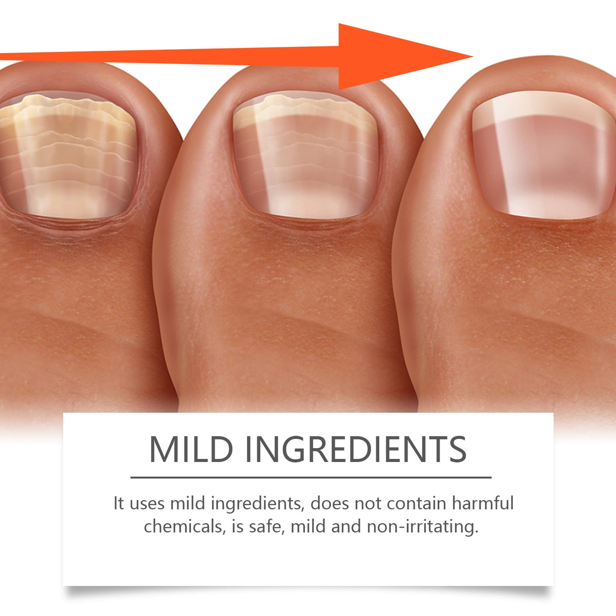 Bee Venom Nail Care Serum for Visibly Healthier Nails