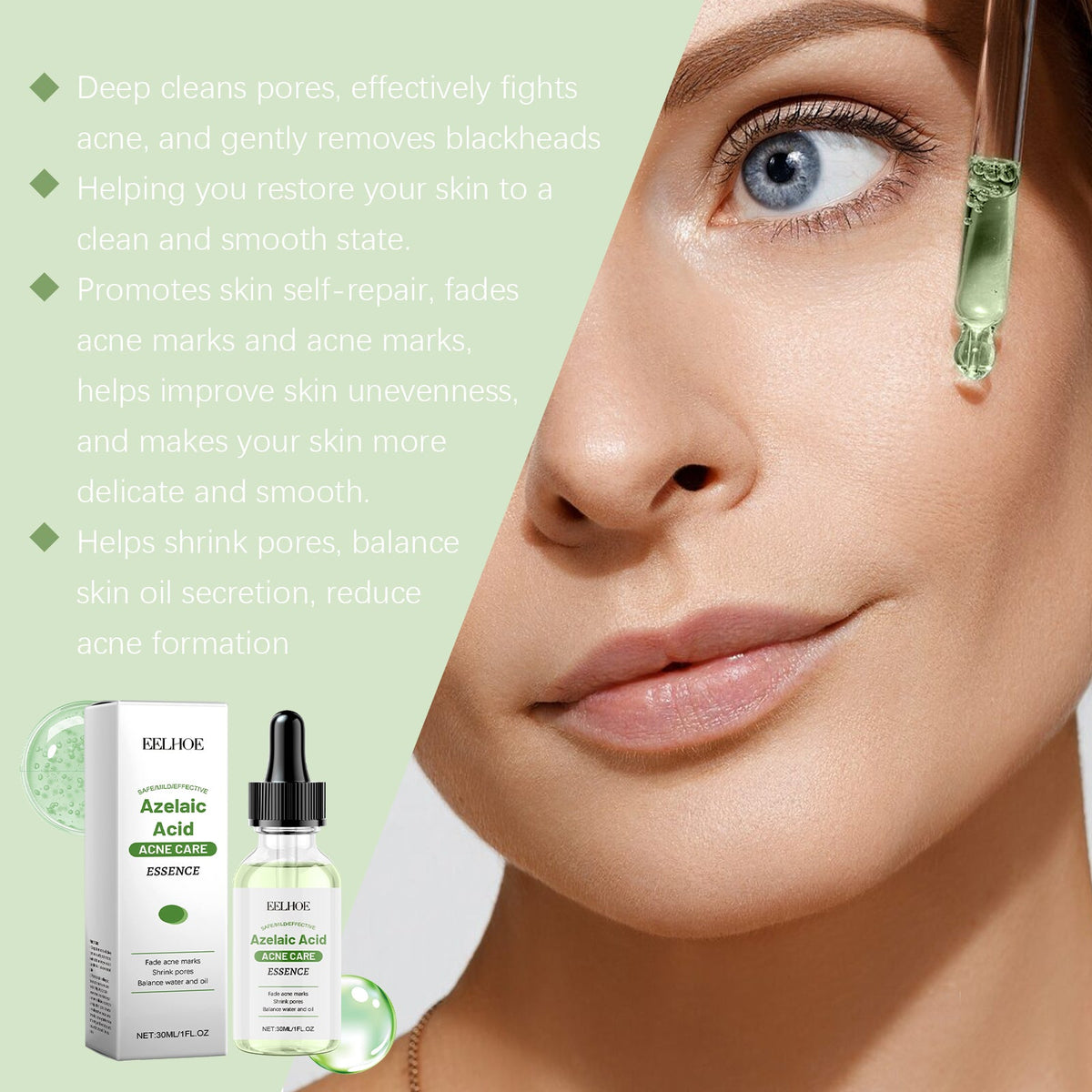 Azelaic Acid Essence for Blackheads, Pores & Acne Marks