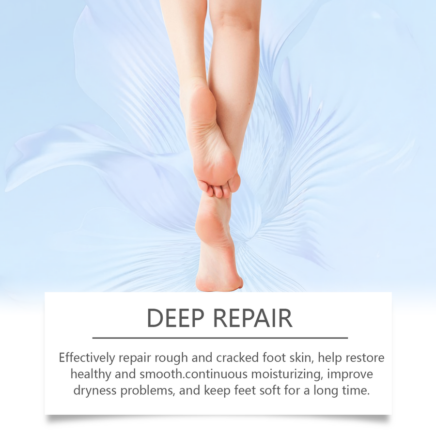 Urea Foot Cream 42% for Cracked Heels & Calluses