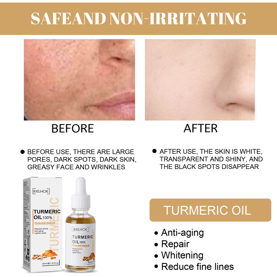 Turmeric Correction Essence for Dark Spots & Fine Lines