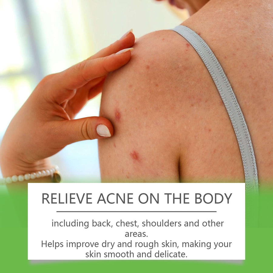 Salicylic Acid Body Acne Spray — Clear Back & Chest Breakouts