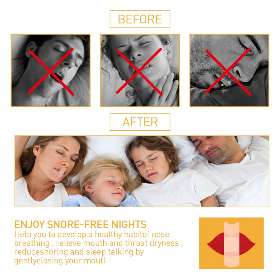 Anti‑Snoring Mouth Tape – Drug‑Free Snore Strips for Quiet Sleep