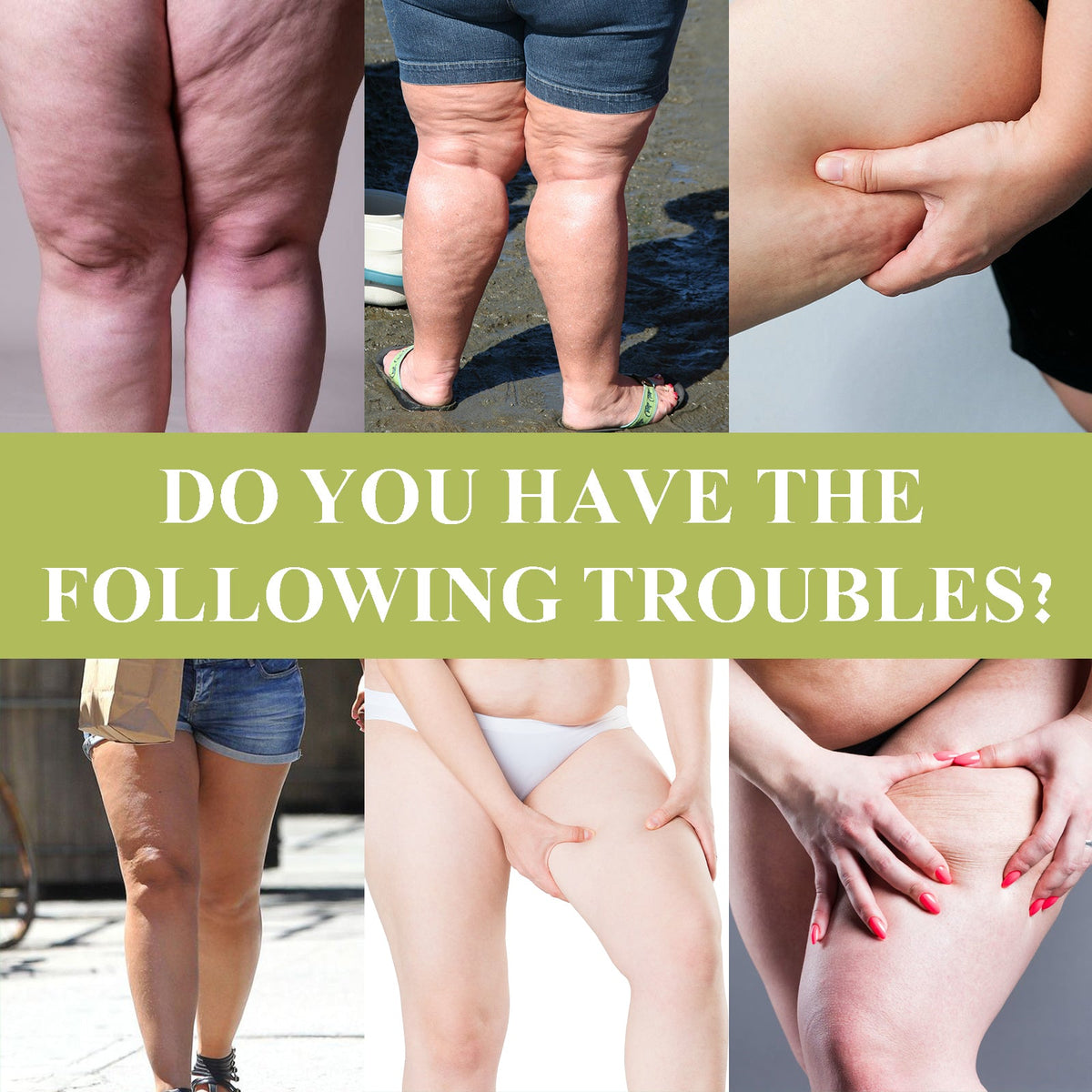 Herbal Cellulite Patches for Legs - 4 Week Reshape