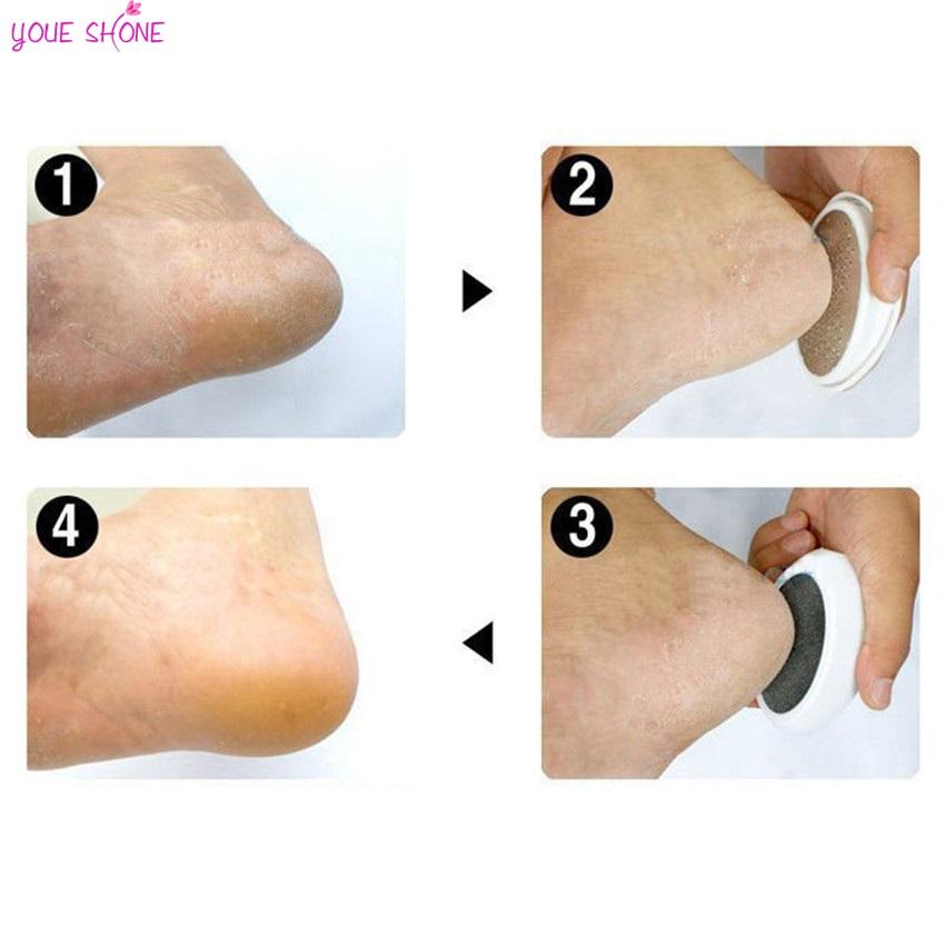 Ped Egg Professional Foot File — Salon-Smooth Feet at Home