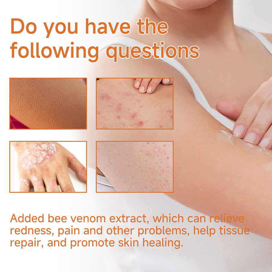 Psoriasis Cream with Bee Venom – Soothes Itch & Repairs Skin