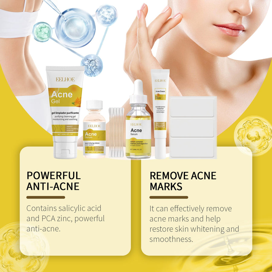 Acne Skincare Set for Oil-Control and Daily Hydration