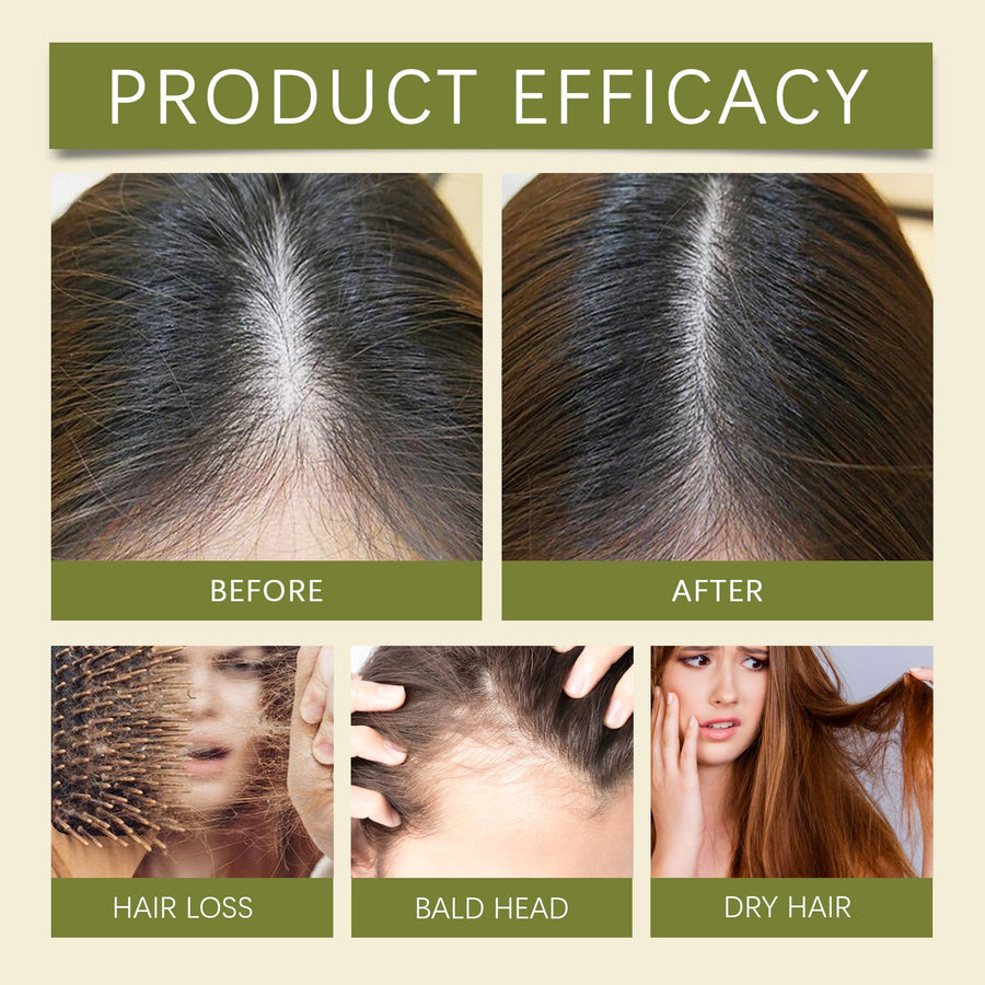 Herbal Hair Growth Oil for Thicker-Looking, Healthier Hair