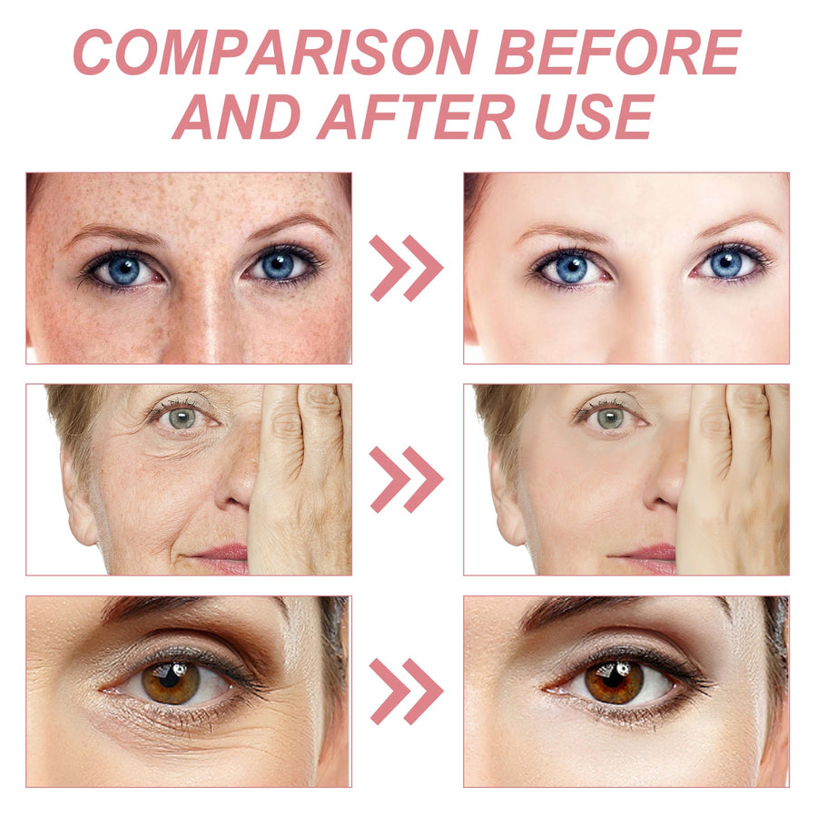 5-in-1 Firming Cream for Wrinkles, Spots & Dull Skin