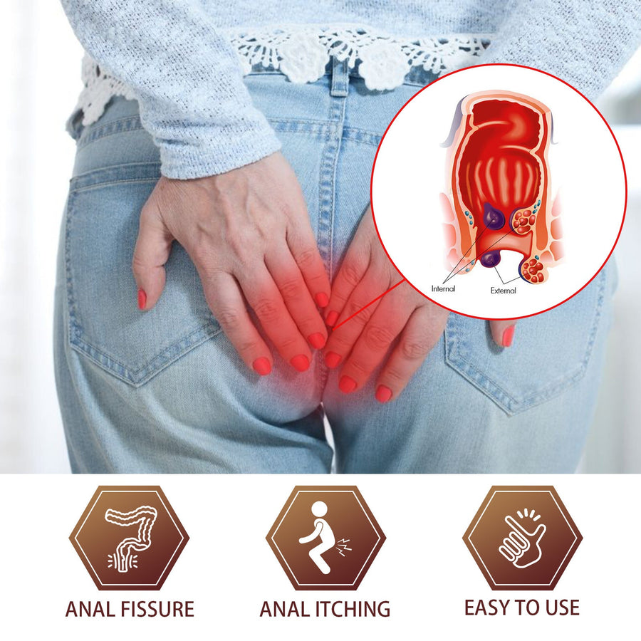 Hemorrhoid Soothing Cream — Gentle Herbal Pain & Itch Relief