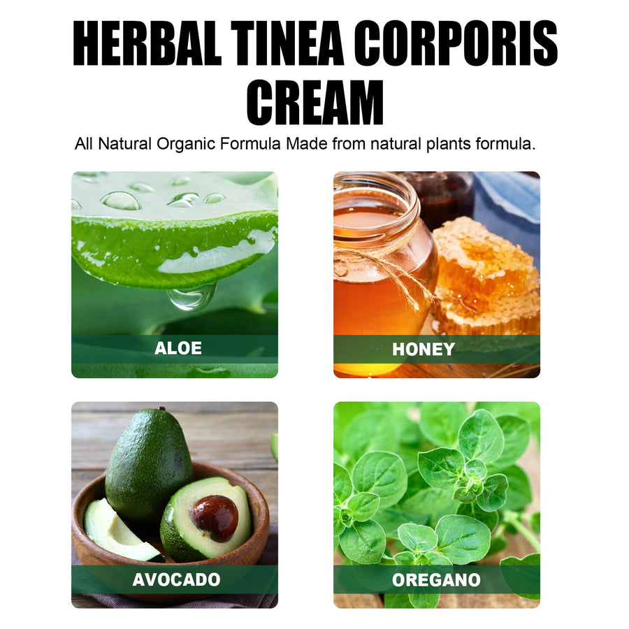 Herbal Tinea Cream for Fungal Itch & Rash Relief