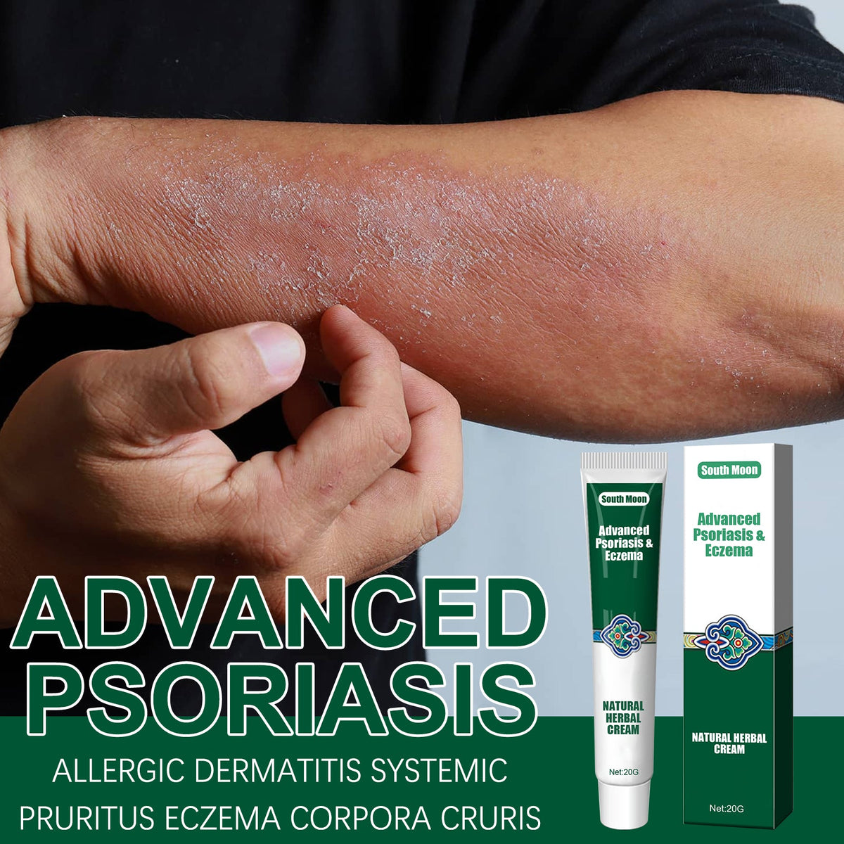 Herbal Soothing Cream for Dry, Itchy & Irritated Skin