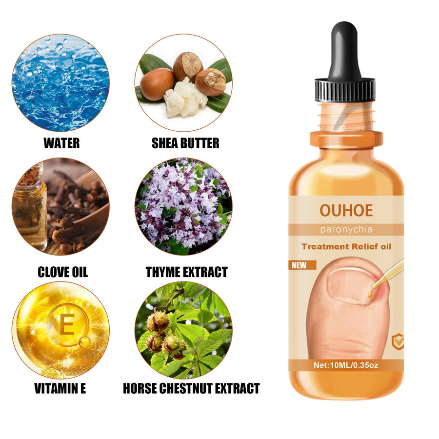 Nail Treatment Oil — Relieves In‑Growing Toenails