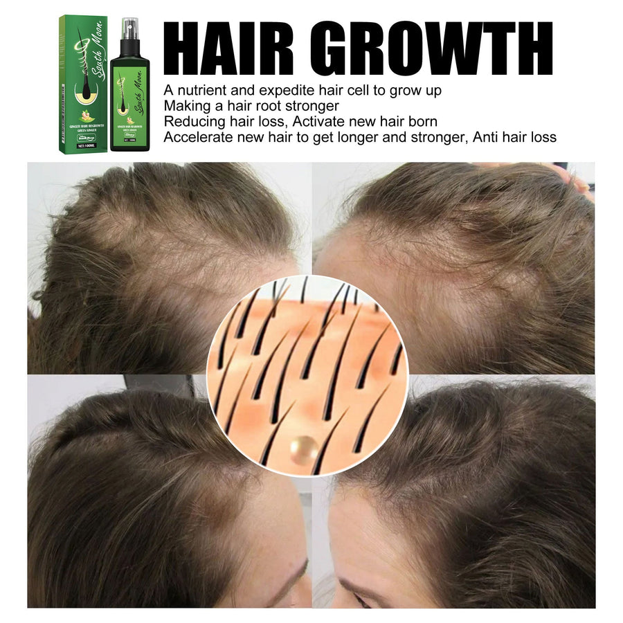 Ginger Hair Scalp Spray for Thinning-Looking Hair