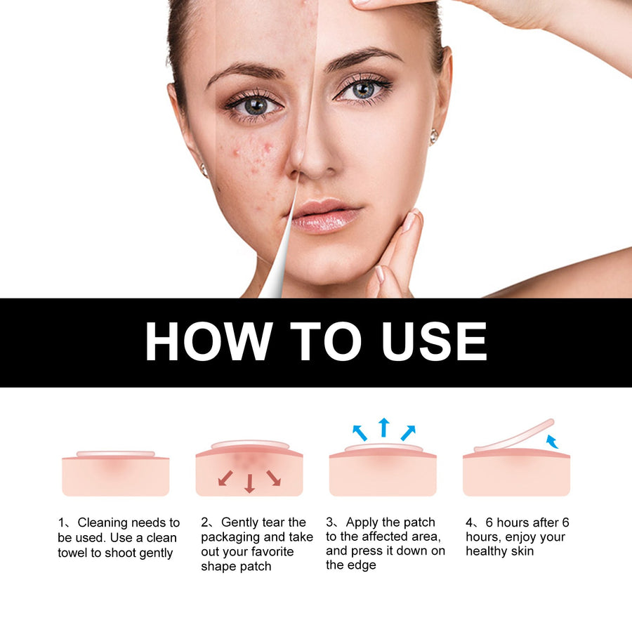 Black Acne Patches for Calming and Covering Blemishes