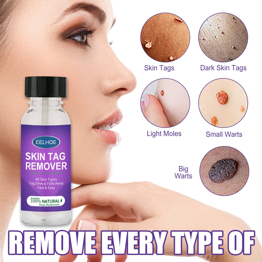 Skin Tag Remover – Natural Mole & Wart Treatment with Thuja