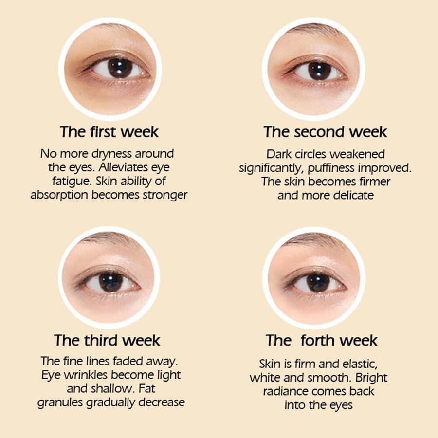 Eye Cream for Dark Circles, Puffiness & Fine Lines