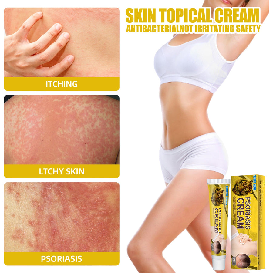 Ringworm Treatment Cream — Visible Skin Repair in Days