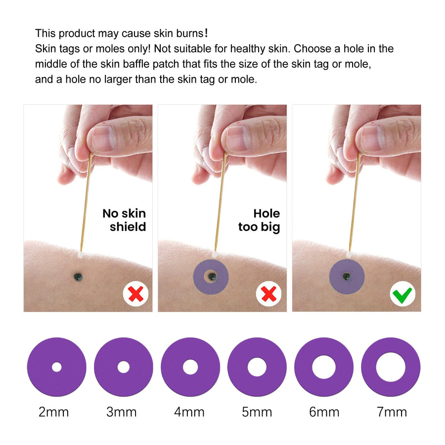 Wart Repair Kit for At-Home Spot Treatment Care
