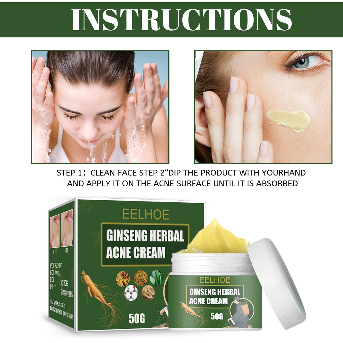 Herbal Ginseng Acne Cream — Clears Breakouts, No Scars