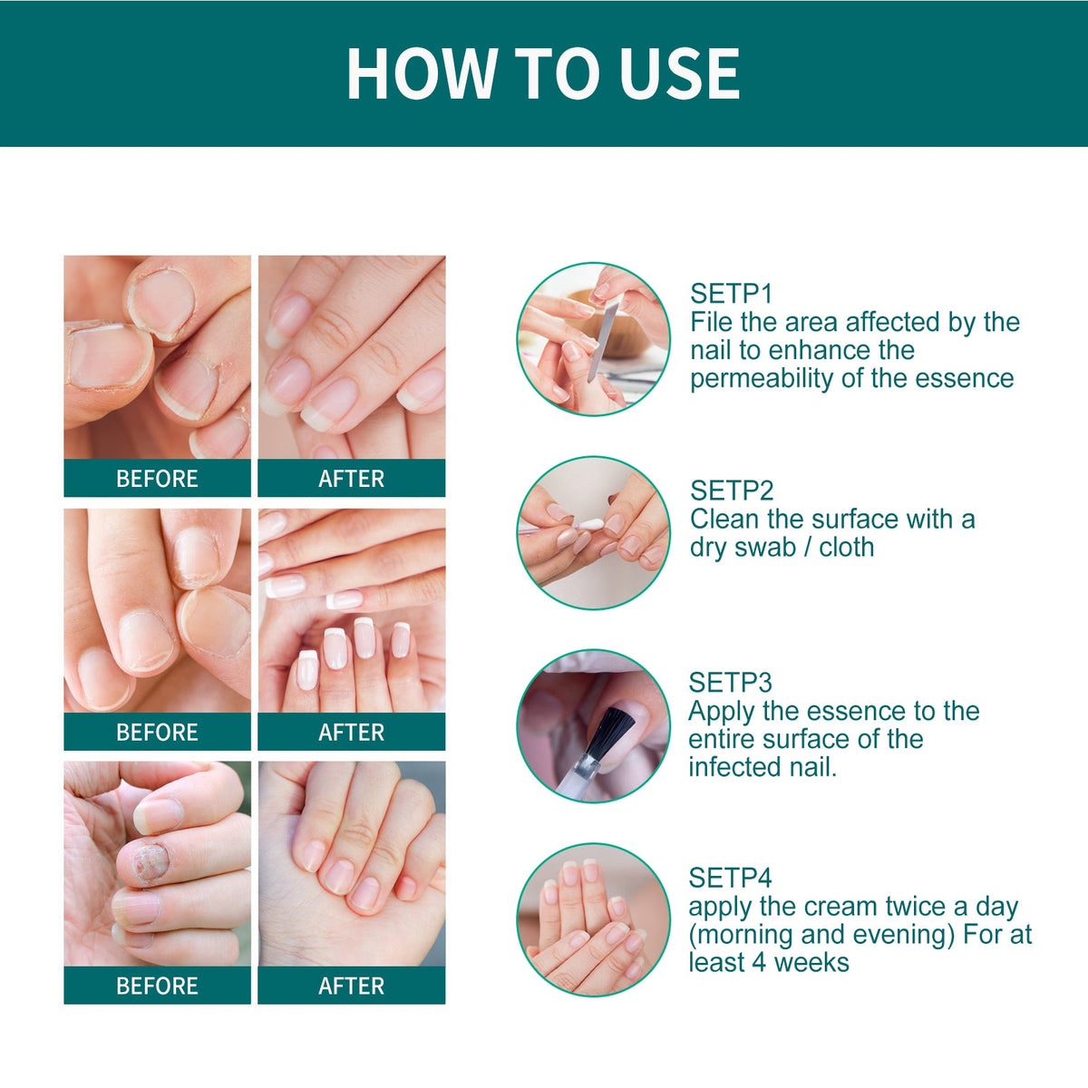 Daily Gentle Toenail Care Roll-On