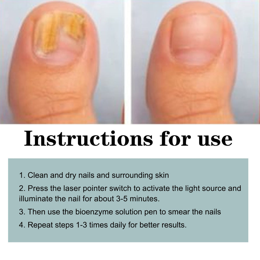 Nail Care Set for Antifungal Repair and Nail Relief