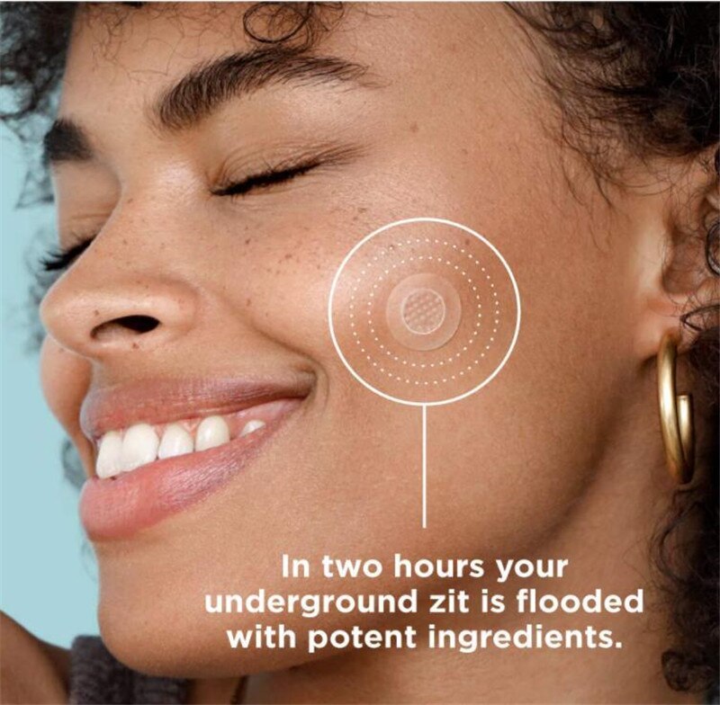 Microneedle Pimple Patch — Clear Pimples in 8 Hours