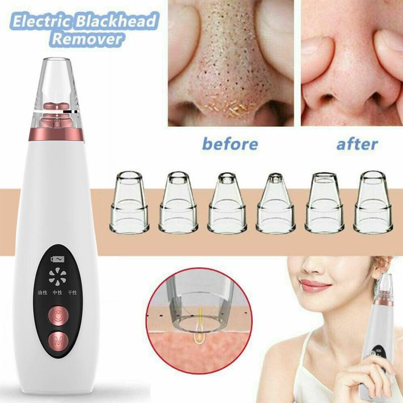 Portable Pore Vacuum — Visibly Clearer Skin in One Use