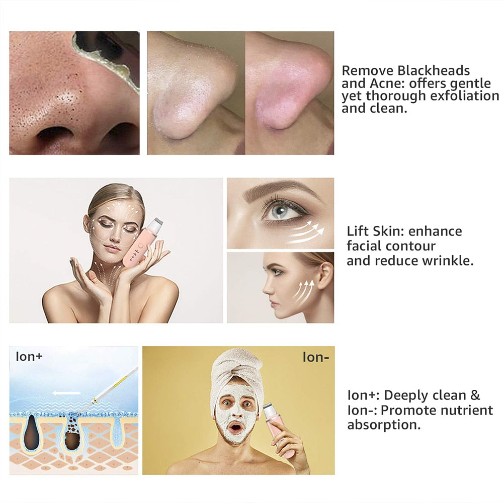 Ultrasonic Skin Scrubber — Clearer, Firmer Skin with Ion