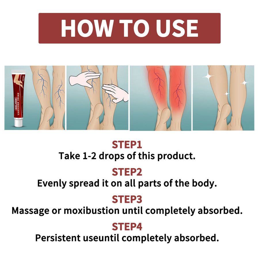 Varicose Vein Cream – Reduce Bulging Veins & Swollen Legs