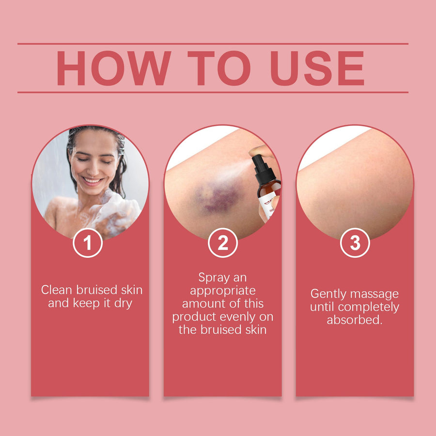 Bruise Relief Spray — Soothe & Heal Bruises Faster