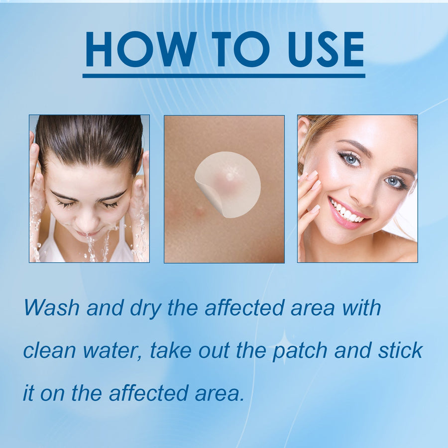 Wart Removal Patches — Safe, Painless 144‑Patch Maximum