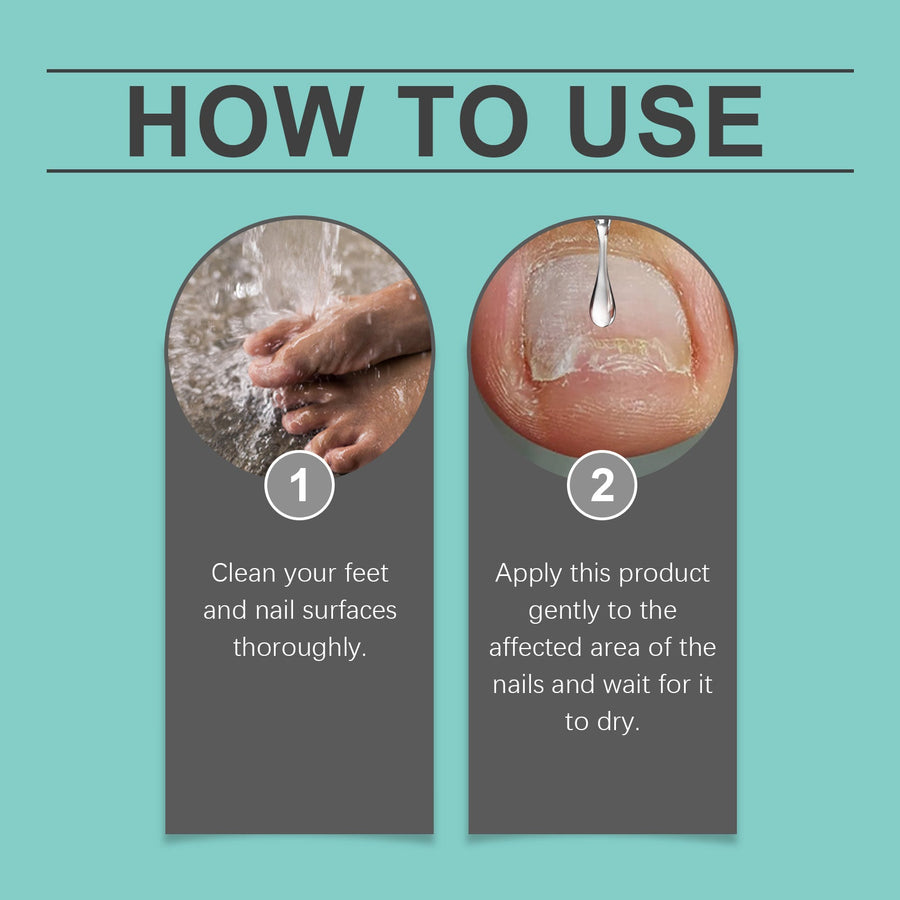 Nail Repair Oil for Paronychia Relief & Cuticle Care