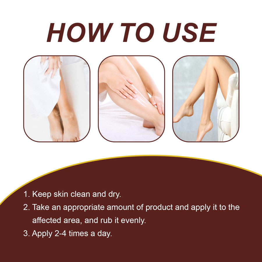 Leg Vein Treatment Cream — Fast At-Home Relief for Varicose