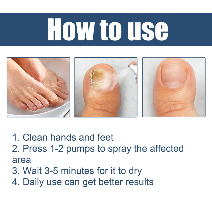 Gray Nail Foot Spray – Gentle Plant‑Based Nail Care